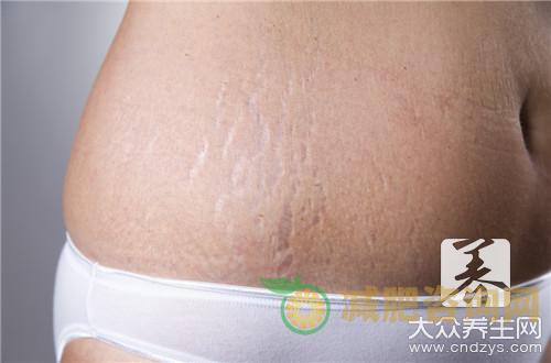 破腹产后怎样减肚子？-第2张图片-减肥咨询网