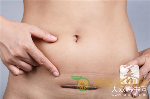 刨妇产后如何减肥-第2张图片-减肥咨询网