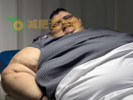 全球最胖