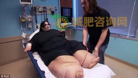 成功减肥