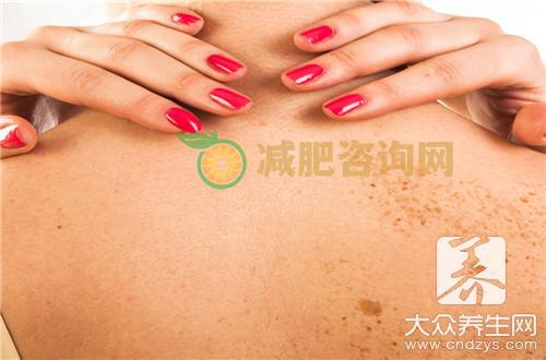 患上多形红斑会传染吗？