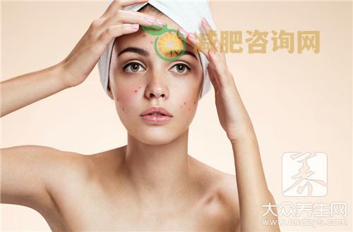 下巴额头长痘痘是什么原因呢？