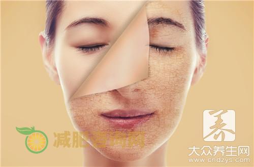 日光过敏性皮炎治疗方法有哪些？