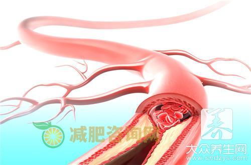 什么是血管瘤呢？
