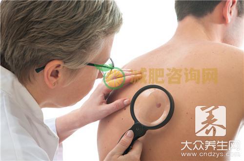 点痣后可以吃木瓜的吗