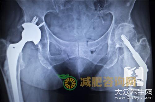 屁股骨头疼怎么回事