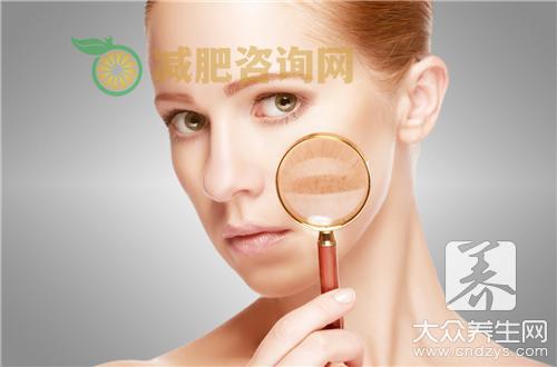 季节性皮炎如何治疗才好？ 