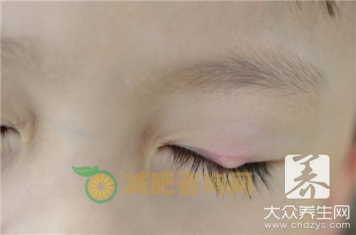 中医治疗麦粒肿，这些药方你记住了吗？