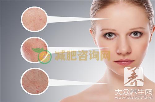 维a酸乳膏正确用法，千万别涂错