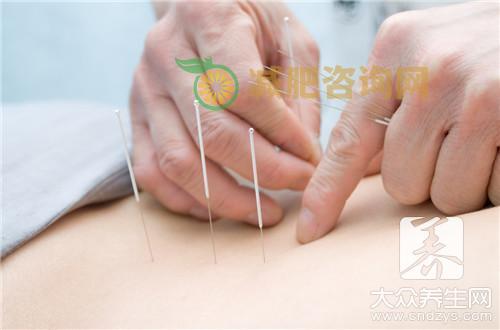 月经期间能针灸减肥吗？