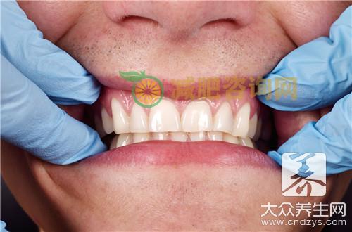 牙齿烟渍怎么去除效果好？