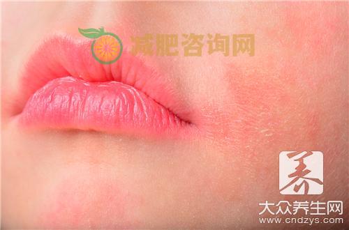 季节性皮炎如何治疗才好？ 