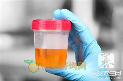尿毒症会腰疼吗，竟还有这些症状
