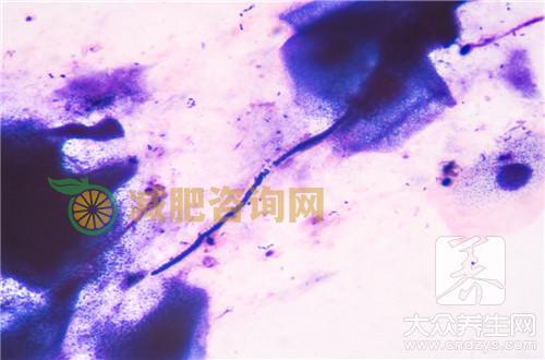 延胡索酸泰妙菌素，这样鉴定